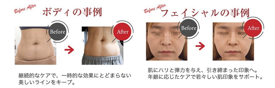 サーモライン事例